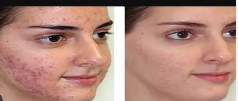 Top 10 Anti Scar Manufacturing Companies In India